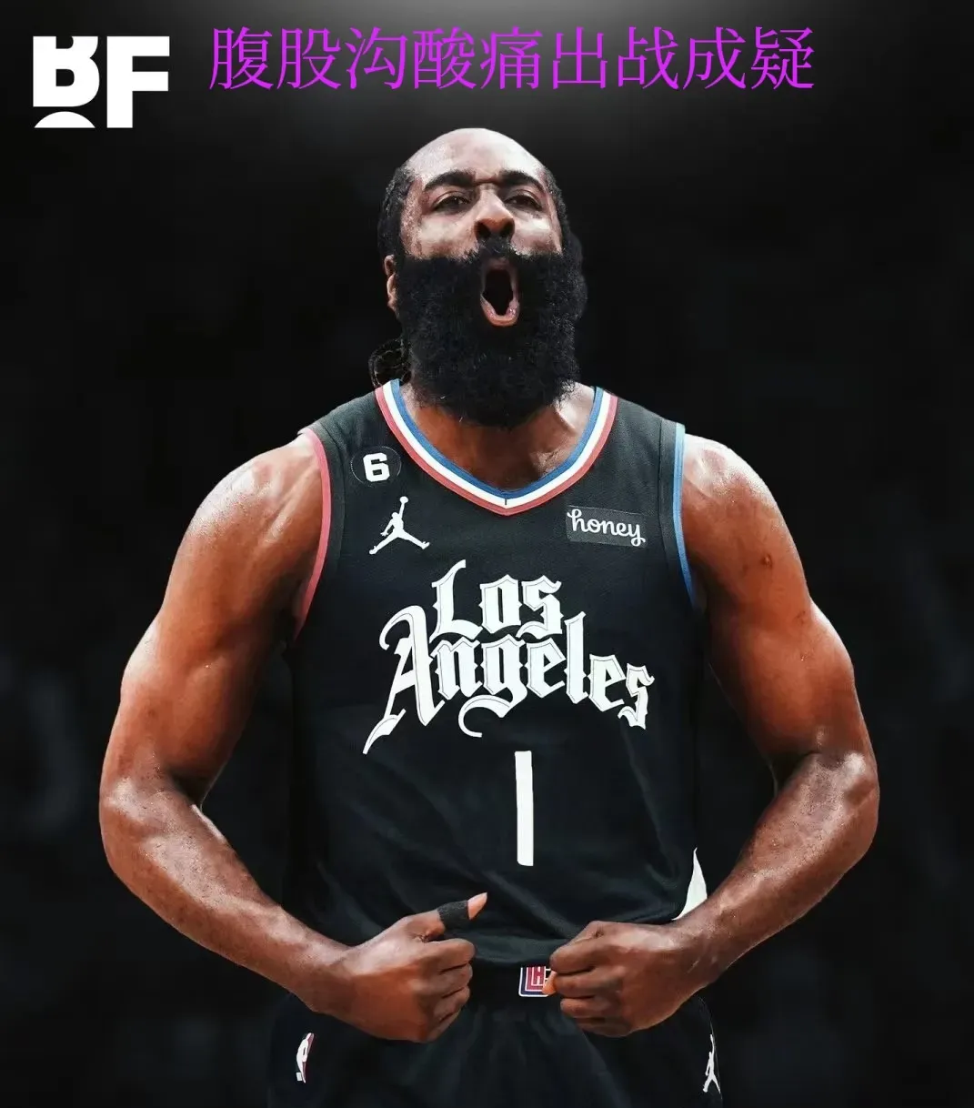 包含火箭主场告负，哈登遭遇尴尬表现的词条